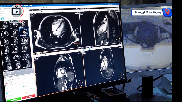 پایان ارجاع بیماران قلبی کودک، ام‌آر‌آی قلب در مرکز طبی کودکان راه‌اندازی شد